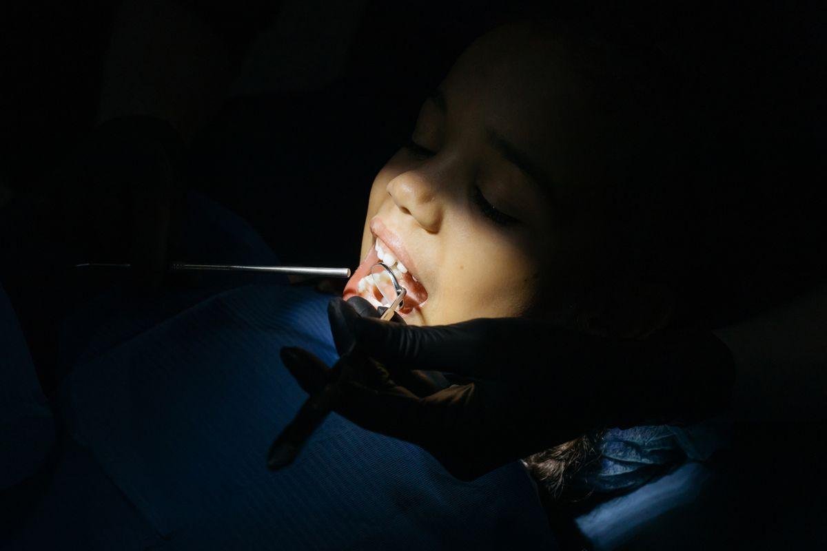 Child at the dentist being checked for early childhood caries