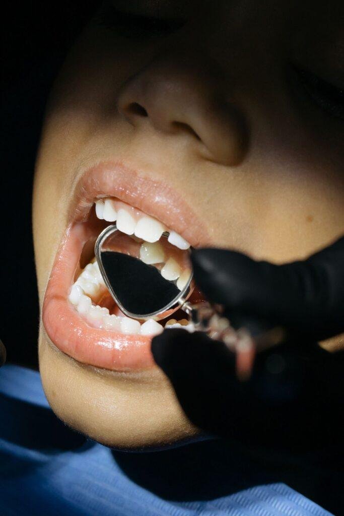 Child receiving preventive dental care such as fluoride varnish